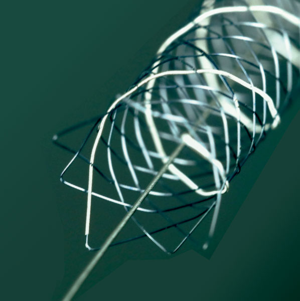 Seguimiento angiográfico a cinco años de aneurismas intracraneales de cuello ancho con stent LEO Plus