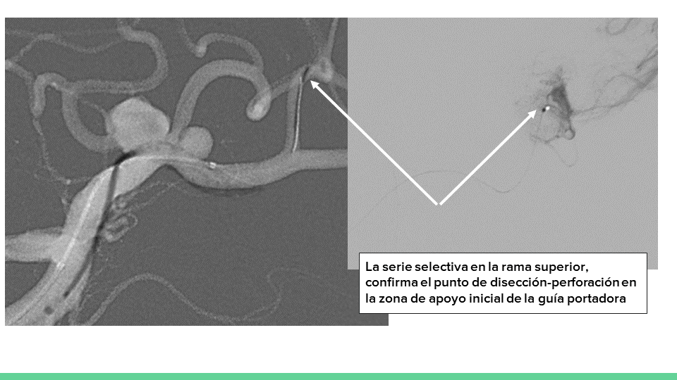 testing.neurointervencionismo.es