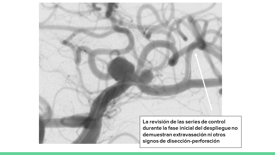 testing.neurointervencionismo.es