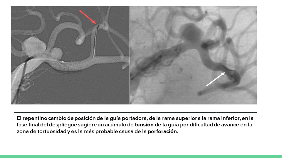 testing.neurointervencionismo.es