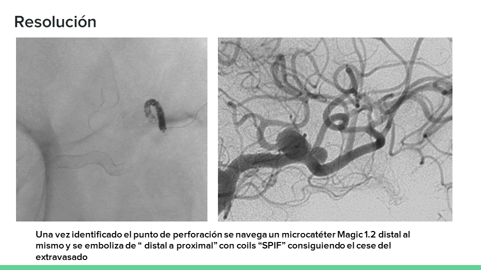 testing.neurointervencionismo.es