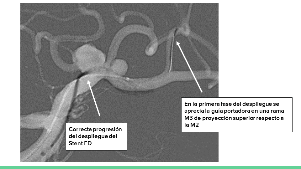 testing.neurointervencionismo.es