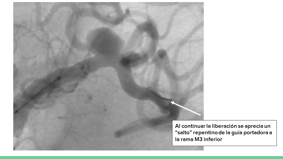 testing.neurointervencionismo.es
