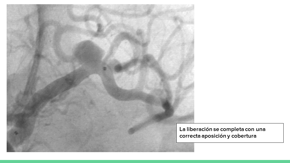 testing.neurointervencionismo.es