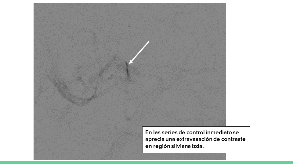 testing.neurointervencionismo.es