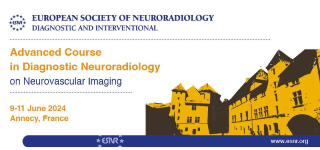 3 Becas Stryker Advanced Course in Diagnostic Neuroradiology on Neurovascular Imaging