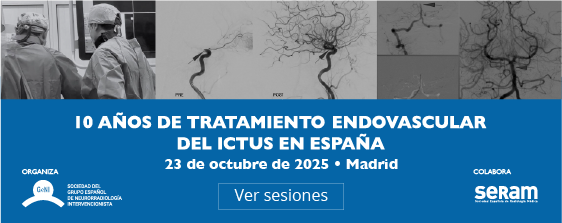Trombectomia25